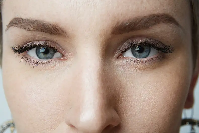 blepharoplasty