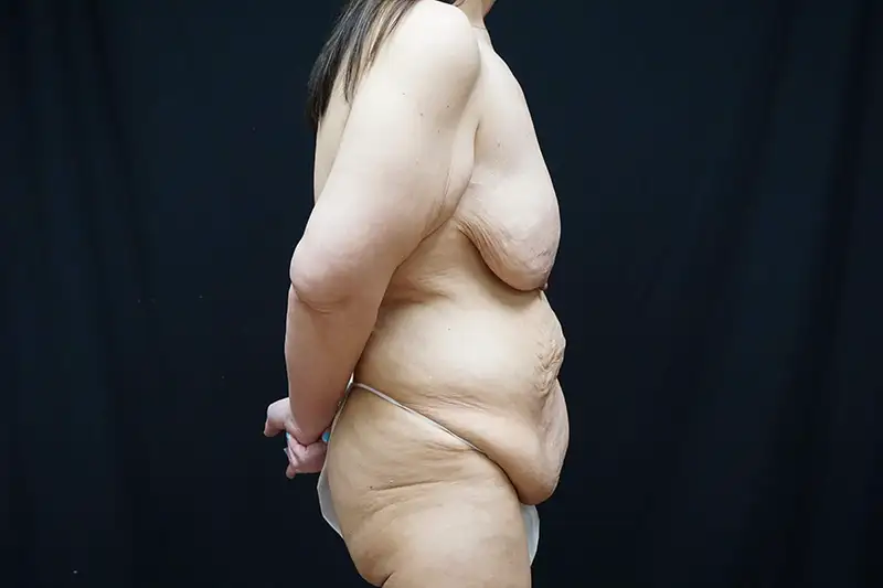 1420372