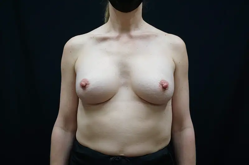 1426071