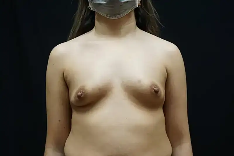1426098-v2